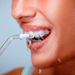 Стоматологи рекомендуют использовать ирригаторы тем, кто носит стоматологические конструкции